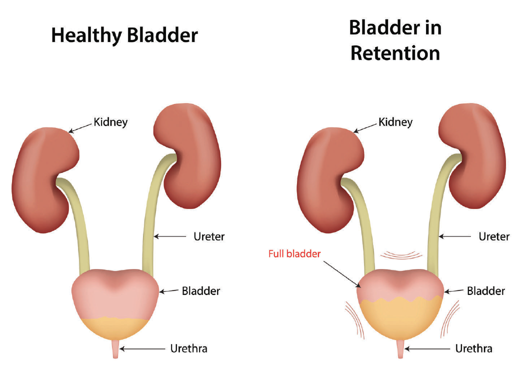 Bladder image