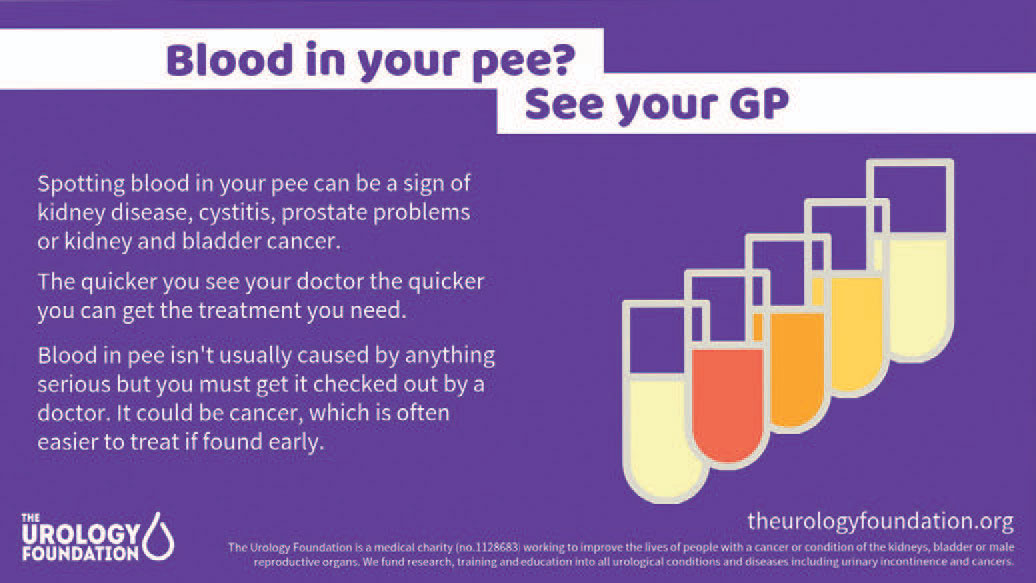 Blood in your pee?