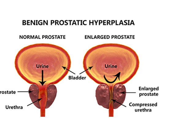 Urology & Continence Care Today